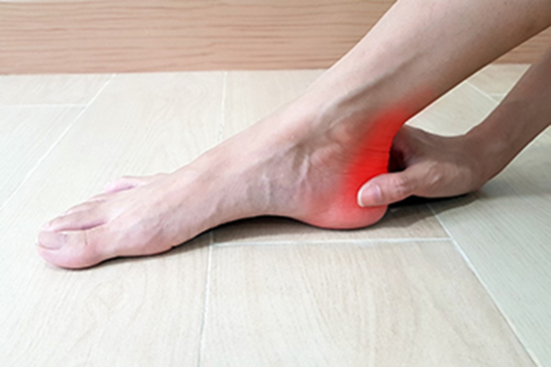 achilles tendonitis
